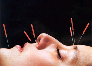acupuncture_face.jpg